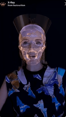 X-Ray