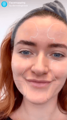 facemapping