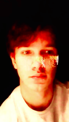 fire freckles