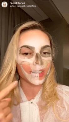 Facial Bones