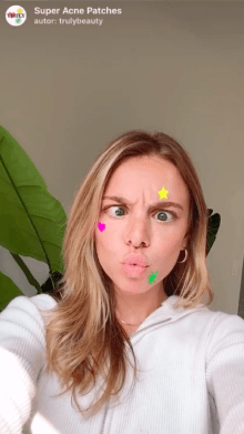 Super Acne Patches