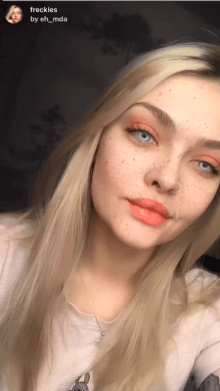 freckles