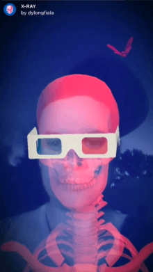 X-RAY