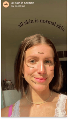 all skin is normal!