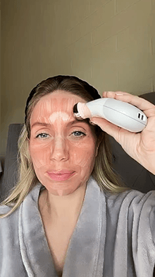 Facial Muscles