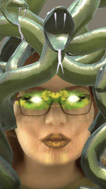 Medusa